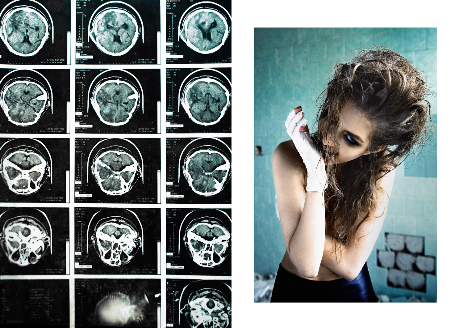 PSYcHOSPITAL - 1 by Csoboth Edina
